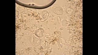 Mixed Ciliates from Hay Infusion [upl. by Laumas]