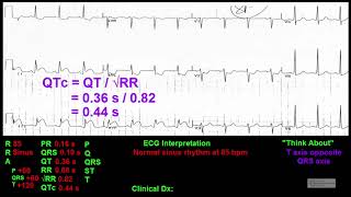 Executive Electrocardiogram Education  Guidelines To ECG Interpretation Preview Video [upl. by Joell]