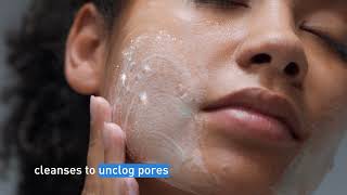 Clear Acne and Prevent New Breakouts │ CeraVe Skincare [upl. by Janis]