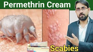 permethrin cream uses in hindi  scabies treatment in hindi  scabies permethrin cream Drx Rabbani [upl. by Dachia]