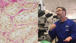 Microscope tutorial  Troubleshooting the Van Gieson stain [upl. by Nwotna]