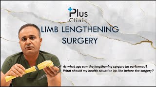 Frequently Asked Questions about Limb Lengthening Surgery  Plus Clinic [upl. by Maddeu312]