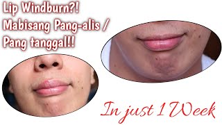 Lip Windburn Remedy  Easy And Affordable Remedy [upl. by Nodnelg]