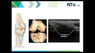 Anatomie en echografie knie deel 1 [upl. by Bassett]