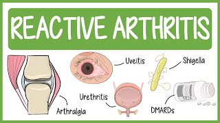 Reactive Arthritis with Mnemonics [upl. by Urana976]