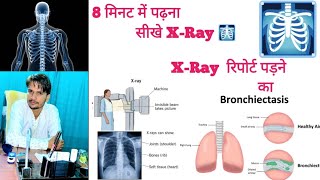 How to read the XRay एक्सरे कैसे पड़ें सीखे 8 मिनट में ।।pharmaknowledgebydrxarman1732 [upl. by Adikram]