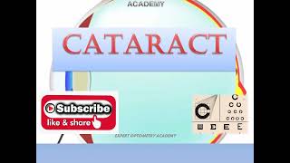 MCQs on CataractMCQs for Ophthalmic technician Optometrist Jr Ophthalmic assistantOphthalmology [upl. by Richia61]