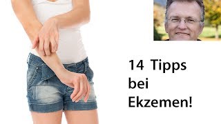 14 Tipps um Ekzeme behandeln [upl. by Ahsuas]