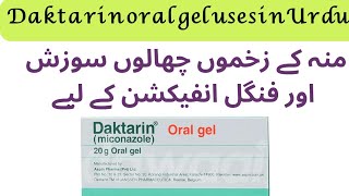 Daktarin oral gel uses  how to use daktarin oral gel  miconazole [upl. by Llertnahs]