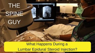 What Happens During a Lumbar Epidural Steroid Injection [upl. by Bryn]