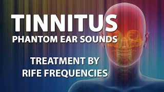 Tinnitus Sound therapy RIFE Frequencies Treatment Relief Meditation Cure Positive Energy Healing [upl. by Ahsien874]