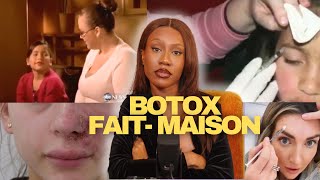 Du botox à ses enfants  La sousestimation et le marketing du botox [upl. by Latoya]