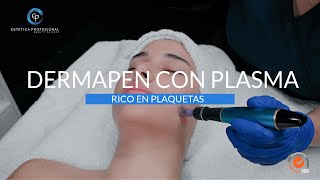 DERMAPEN CON PLASMA RICO EN PLAQUETAS l EP ESTETICA [upl. by Lambart]