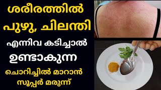 ചിലന്തി പഴുതാര പുഴു തൂവണം ഇല എന്നിവ കടിച്ചാൽ ഉണ്ടാകുന്ന ചൊറിച്ചിൽ മാറാൻ  Health Tips Malayalam [upl. by Norvall]