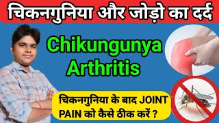 Chikungunya जोड़ो का दर्द कब तक चलेगा  Chikungunya joint pain treatment hindi  Chikungunya symptoms [upl. by Nosduh]