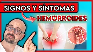 ¿Hemorroides o Cáncer de Colon  SIGNOS y SÍNTOMAS que indican HEMORROIDES [upl. by Arocat]