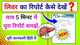 लिवर का रिपोर्ट रिपोर्ट कैसे देखें।।lft test report kaise dekhe।।Liver function test report analysis [upl. by Rebliw612]