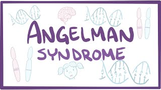 Angelman syndrome  causes symptoms diagnosis treatment pathology [upl. by Delsman]