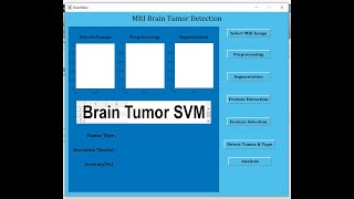 Brain Tumor Detection Using Matlab SVM [upl. by Lennahs]