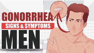 Signs and Symptoms of Gonorrhea in Men  sexually transmitted disease [upl. by Rosemari]