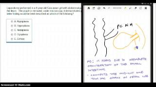 138 FA MECKELS DIVERTICULUM [upl. by Atul]