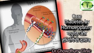 मधुमेह l Diabetes l Homoeopathy Treatment for diabetes l [upl. by Mode]