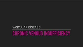 Chronic Venous Insufficiency [upl. by Kimberli565]