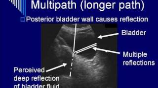 Physics of Ultrasound Image Artifacts Segment 4 [upl. by Aiynat]