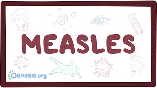 Measles  causes symptoms diagnosis treatment pathology [upl. by Bouchard]