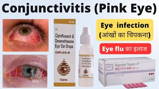 Treatment of Eye Flu in Hindi  Eye flu  आंखों का चिपकना का इलाज  Conjunctivitis in hindi [upl. by Maffei]