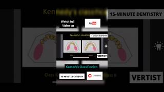 Kennedys Classification  Preclinical Prosthodontics and Conservative Dentistry shorts [upl. by Eardnoed]