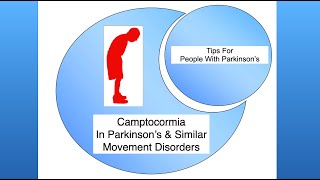 Camptocormia in Parkinsonism [upl. by Alicia343]