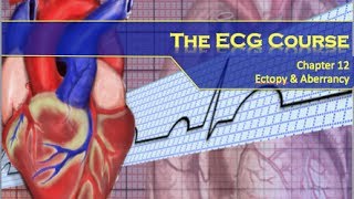 The ECG Course  Ectopy amp Aberrancy [upl. by Obediah735]