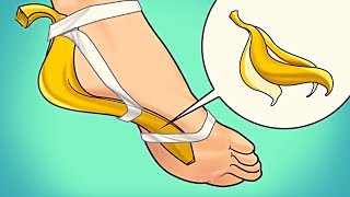 Usa la Buccia di Banana in Questo Modo Per Una Settimana e Scopri Cosa Succede al Tuo Corpo [upl. by Fabiola]