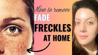 How to get rid of freckles on face  Dr Swetha Sunny Paul [upl. by Etterrag46]