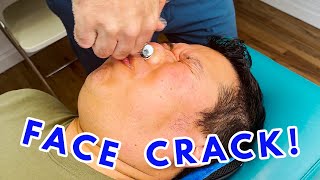 TMJ RELIEF AFTER ONE ADJUSTMENT  A FACE CRACK [upl. by Unity]