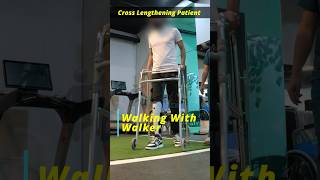 Walking with walker  Achieved 11cm Height  Limb lengthening surgery in India heightsurgery [upl. by Devinne]