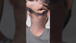 Neck Cleaning Tips amp Trick  Get Fair Neck In 5min  Neck Darkness Removal Pack beautytips shorts [upl. by Aerdnod642]