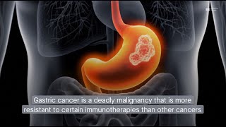 How do IL10producing B cells help gastric cancer evade the immune system [upl. by Ahsilra]