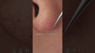 Your face should be clean velvethair blackhead immersiveskincare deepporecleansing skin [upl. by Aivin]