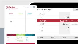 Reading the blood gas report using TicTacToe – Radiometer [upl. by Narcissus189]