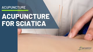 Acupuncture for sciatica pain [upl. by Anastasio995]