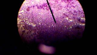 STAPHYLOCOCCUS EPIDERMIDISGRAM STAINED [upl. by Licha23]