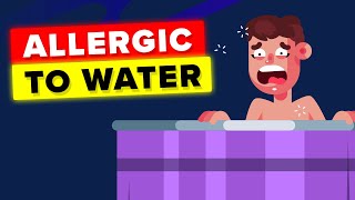 Woman Allergic to Water This is How She Lives [upl. by Ayerhs699]