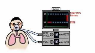 CPAP and NonInvasive Ventilation in 5 minutes [upl. by Faux]