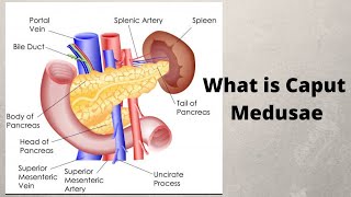 What is Caput Medusae [upl. by Eimaral518]