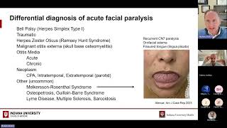 Facial Nerve Disorders Rick F Nelson MD PhD Indiana University April 15 2024 [upl. by Jens]