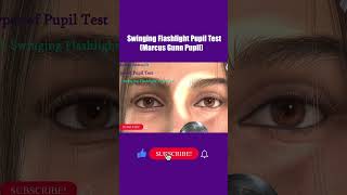 Pupil Examination  RAPD  Pupillary Light Reflex  Marcus Gunn Pupil  Swinging flashlight Test [upl. by Dronel264]