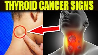 10 WARNING Signs Of Thyroid Cancer You Must Not IGNORE [upl. by Stefanie425]