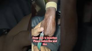 Deep veins injection trending shorts video drxsachin12 [upl. by Terrijo]